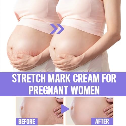 Silhouette Support Belly Cream